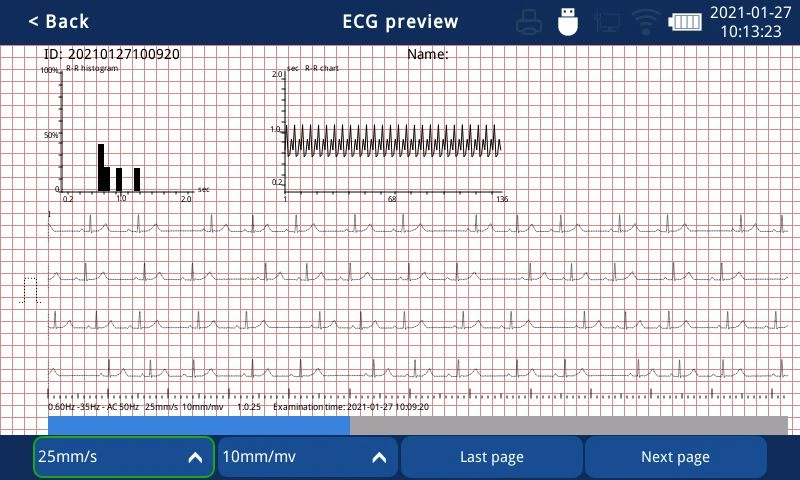 touch screen EKG machine